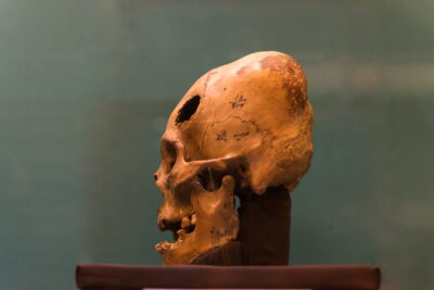Crâne de Paracas